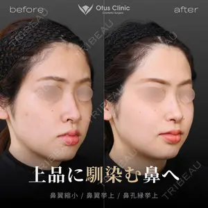 Otus Clinic 【オータスクリニック】 中 徳太郎医師の症例
