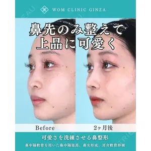 WOM CLINIC GINZA （ワム クリニック ギンザ） 中井 孝昌医師の症例