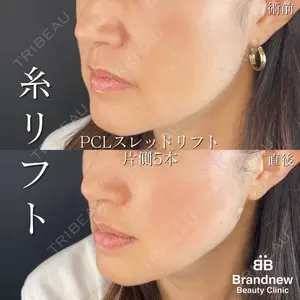 Brandnew Beauty Clinicの症例