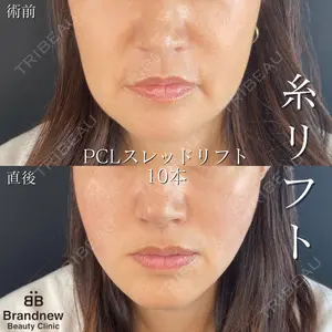 Brandnew Beauty Clinicの症例