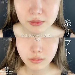 Brandnew Beauty Clinicの症例