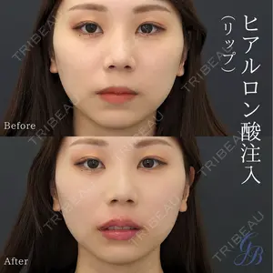 銀座美容外科クリニック 銀座院の症例