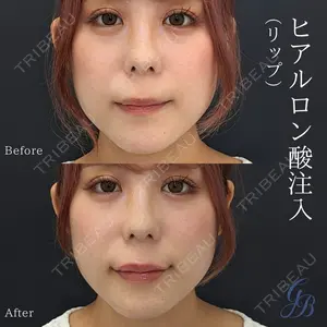 銀座美容外科クリニック 銀座院の症例