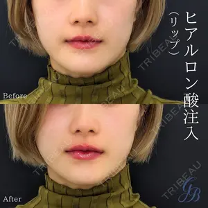 銀座美容外科クリニック 銀座院の症例