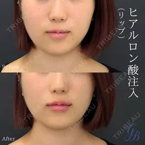 銀座美容外科クリニック 銀座院の症例