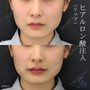 銀座美容外科クリニック 銀座院の症例