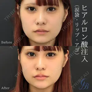 銀座美容外科クリニック 銀座院の症例