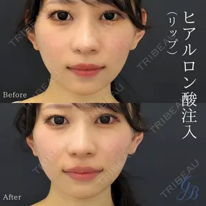 銀座美容外科クリニック 銀座院の症例