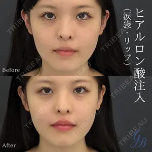 銀座美容外科クリニック 銀座院の症例