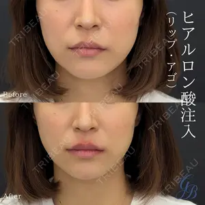 銀座美容外科クリニック 銀座院の症例