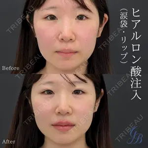 銀座美容外科クリニック 銀座院の症例