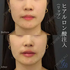 銀座美容外科クリニック 銀座院の症例