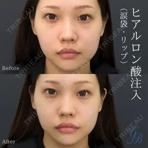 銀座美容外科クリニック 銀座院の症例