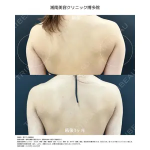 湘南美容クリニック 博多院 馬渡 奈々医師の症例