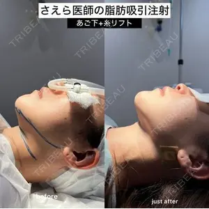 EMMO FACE CLINIC 大阪梅田院 山﨑 冴羅医師の症例