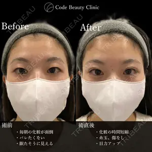 Code Beauty Clinic 名古屋院 橋本 祥平医師の症例