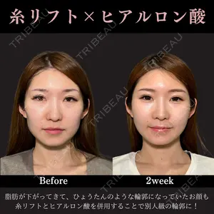 PRISM Beauty Clinic 畑山 知輝医師の症例