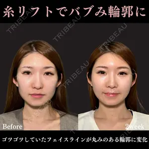 PRISM Beauty Clinic 畑山 知輝医師の症例