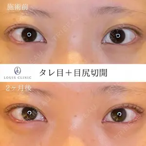 LOUIS CLINIC 二子玉川院【ルイクリニック】 小松 塁医師の症例