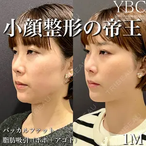 YBC横浜美容外科 大宮院 磯村 亮輔医師の症例