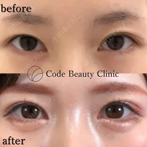 Code Beauty Clinic 名古屋院 橋本 祥平医師の症例