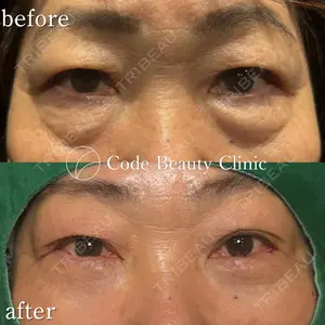 Code Beauty Clinic 名古屋院 橋本 祥平医師の症例