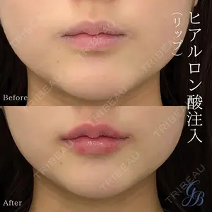 銀座美容外科クリニック 銀座院の症例