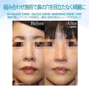 聖心美容クリニック 銀座院 牧野 陽二郎医師の症例