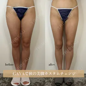 GAYA body design clinic 飯ヶ谷 重来医師の症例