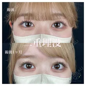 AI Beauty Clinic （エーアイ美容クリニック） 田中 里佳医師の症例