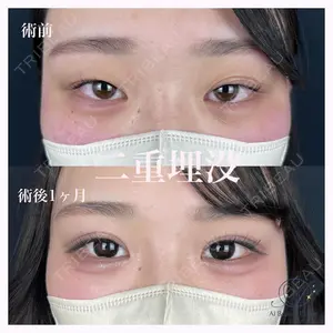 AI Beauty Clinic （エーアイ美容クリニック） 田中 里佳医師の症例