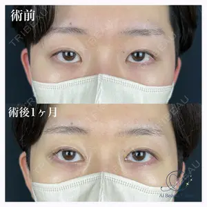 AI Beauty Clinic （エーアイ美容クリニック） 田中 里佳医師の症例