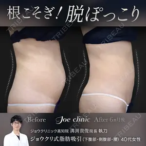 ジョウクリニック 高知院 溝渕　貴俊医師の症例