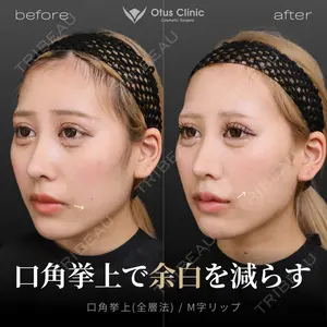 Otus Clinic 【オータスクリニック】 中 徳太郎医師の症例