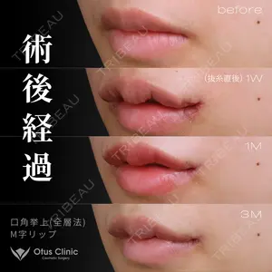 Otus Clinic 【オータスクリニック】 中 徳太郎医師の症例