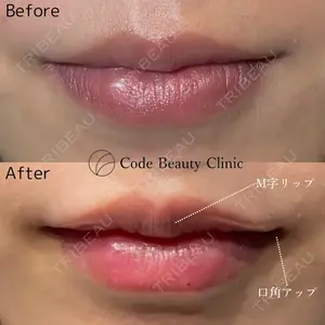 Code Beauty Clinic 名古屋院 橋本 祥平医師の症例