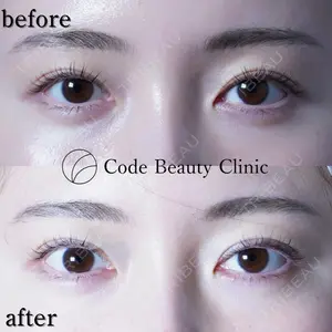 Code Beauty Clinic 名古屋院 橋本 祥平医師の症例