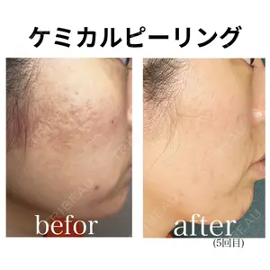 椿クリニック 名古屋院の症例