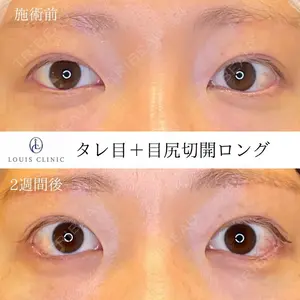 LOUIS CLINIC 二子玉川院【ルイクリニック】 小松 塁医師の症例