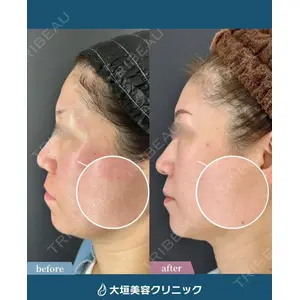 大垣美容クリニックの症例