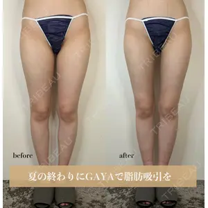 GAYA body design clinic 飯ヶ谷 重来医師の症例