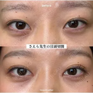 EMMO FACE CLINIC 大阪梅田院 山﨑 冴羅医師の症例