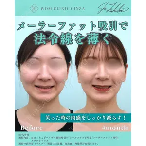 WOM CLINIC GINZA （ワム クリニック ギンザ） 深堀 純也医師の症例
