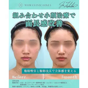 WOM CLINIC GINZA （ワム クリニック ギンザ） 深堀 純也医師の症例