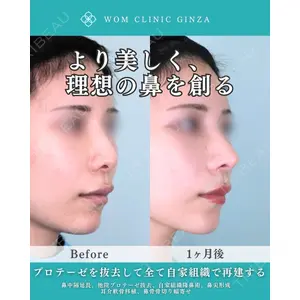WOM CLINIC GINZA （ワム クリニック ギンザ） 中井 孝昌医師の症例