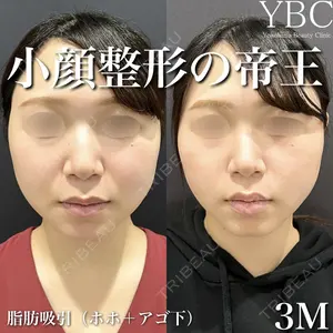 YBC横浜美容外科 大宮院 磯村 亮輔医師の症例