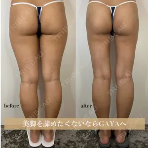 GAYA body design clinic 飯ヶ谷 重来医師の症例