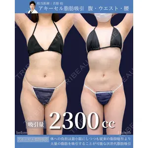 東京シンデレラ美容外科 新宿院 吉原 伯医師の症例