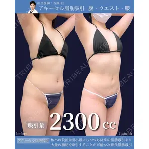 東京シンデレラ美容外科 新宿院 吉原 伯医師の症例