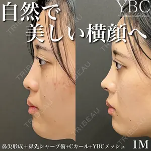 YBC横浜美容外科 大宮院 磯村 亮輔医師の症例